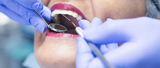 Best Emergency Gum Treatment in USA